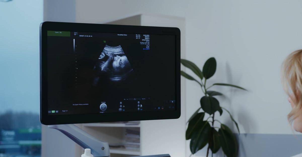 3d扫描孕妇婴儿B超声4K高清CC0视频素材插图