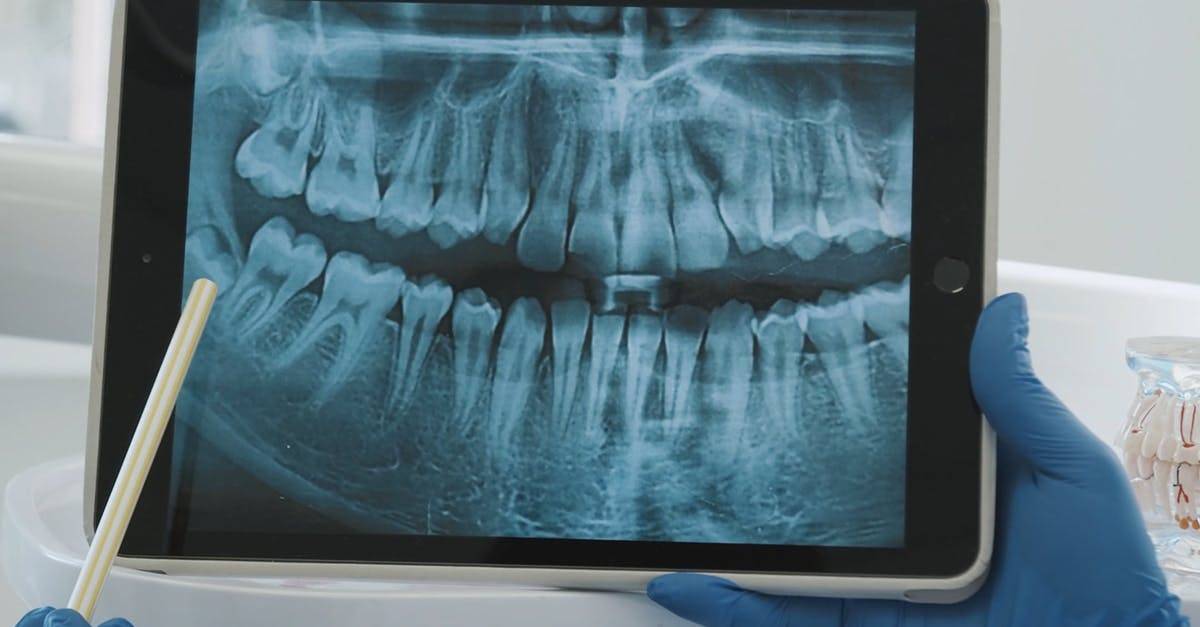 x-射线牙科x光片4k牙齿特写高清CC0视频素材插图